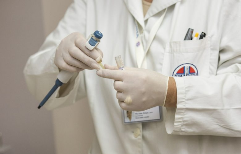 Sospetto caso di Aviaria in Campania a Castel Volturno